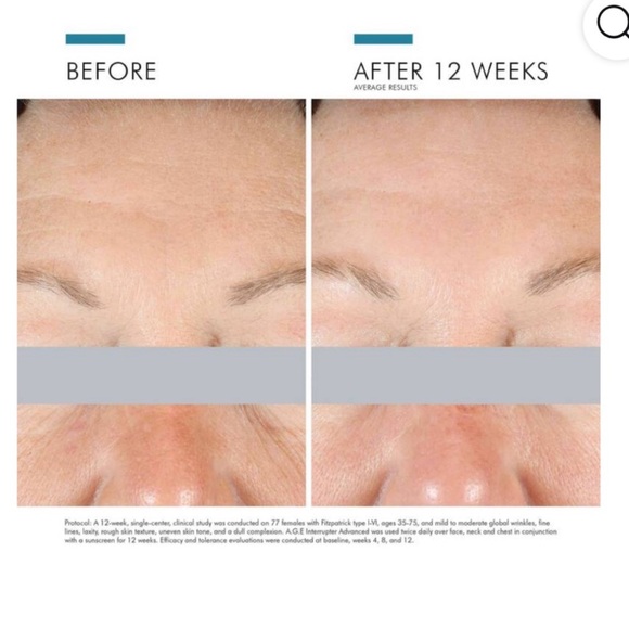 Skinceuticals AGE Interrupter Advanced 120ml- PRO size - Picture 9 of 13